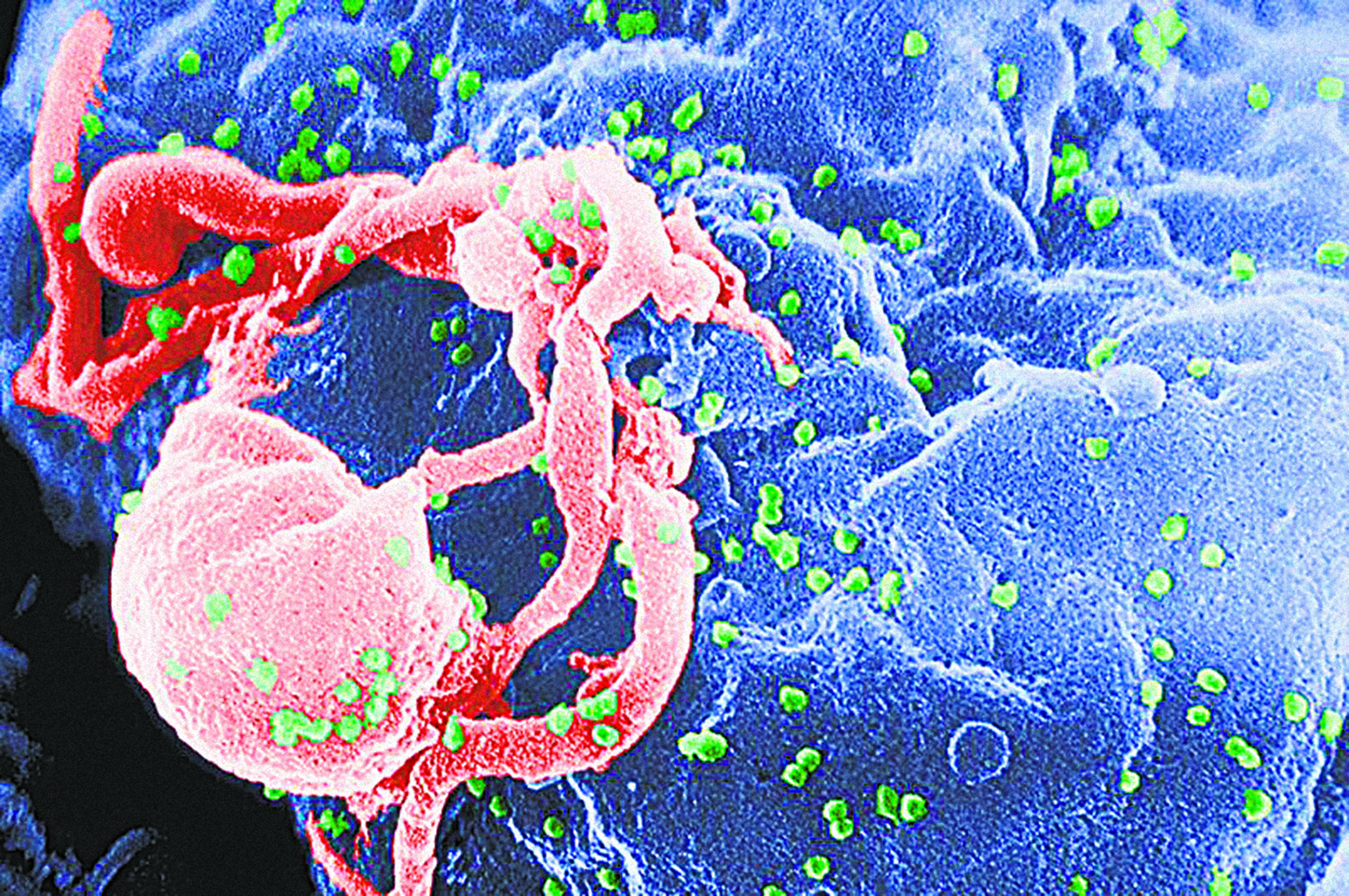 Scanning electron micrograph of HIV-1 (in green) (35467)
